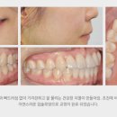 연세고운미소치과의원 이미지