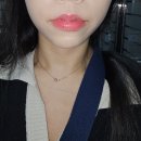 엔디어트의원 | [엔디어트의원] 인모드 FX&amp; 포마 내돈내산 후기 / 이중턱·심부볼 전후 비교🔥