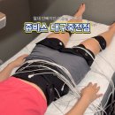 죽전 | 대구위고비 대신 선택한 쥬비스 대구죽전점 감량후기