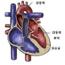 대동맥판막협착증대동맥 협착증, 대동맥판 협착증, 대동맥막 협착증 이미지