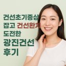 광진 | 건선초기증상 잡고 건선완치 도전한 광진건선 후기