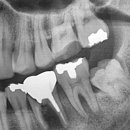 뿌리심는치과의원 이미지