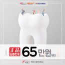 리더스함치과의원 | 리더스함치과, 어금니임플란트비용 알아보기