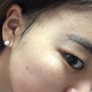 엘잇뷰티 | 67)앨잇뷰티,엘잇뷰티프란츠팩,전류팩,셀프예신관리 ㅋㅋㅋㅋ