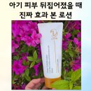 아기 피부 뒤집어졌을 때 리숨센텔라 시카 로션 후기