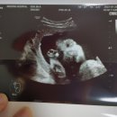 안동성소병원 산후조리원 이미지