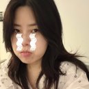 시온한방병원 | 단일공복강경 수술 후기2. with 시온 이현철과장님