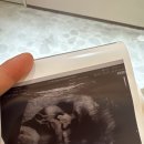 11260-2-35-7 | 강남차병원 35주 응급제왕절개 후기｜김문영 교수님, NICU 입원부터 회복까지 + 입원 일차별 기록 &amp; 꿀팁