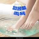 레푸스 이미지