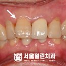 서울아인치과의원 이미지