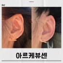 합성동101 | 마산 합성동 통증관리 전문 아르케뷰센 이어테라피 처음 받아본 후기