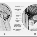 알츠하이머 치매 - suboccipital release 테크닉 기억개선 논문!! 이미지