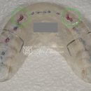 예스치과기공소 이미지