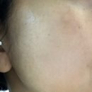 아우라뷰티끄 | 부천피부관리 수앤수뷰티끄 마르지아클리닉 호르몬쨈으로 피부보습 꽉채워요