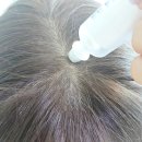 스카이유 | 두피앰플 열 오르고 민감해진 두피 빠른 진정 탈모 케어까지 한 번에 끝내는 스카비올 신제품 후기