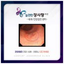 늘편한장사랑의원 네이버블로그