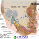 [안면마비 과로/광주안면마비한의원]/광주구안와사클리닉 이미지