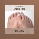 신정동네일 네일드잇 신정점 | 파고드는 발톱 교정 전문 아크릴 네일 후기