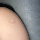 주내과의원 | [강동구/천호]속든든내과의원 백일해주사 후기