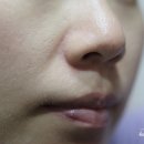 블루세라