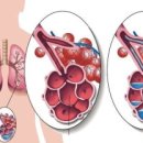 에스케이메디케어 이미지