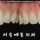 서울예봄치과 이미지