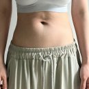 엑셀고급 | 선릉역피부과 바디리프팅 엑셀튠 라인조각술 효과 후기