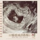 범서읍보건지소 | 임신 7주차 초음파 난황과 심장소리 임밍아웃하기!