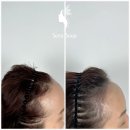 새로이숲부평 | 자연스러운 두피 커버 효과, 인천두피문신 잘하는 곳 추천