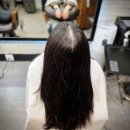 수원 | 수원 링거펌 후기, 제주에서 찾아온 율전동 링거펌 정수리 볼륨 대변신