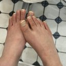 덕천빌딩 | 부산 문제성 발톱 교정은 레푸스하세요 덕천 레푸스 발관리 후기