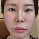 신사초등 | 신사역 반사판 플렉스 부스터 엘라비에 리투오 내돈내산 후기