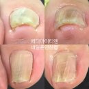 네일죤 이미지