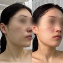 더안헬스케어 | 진주 주약동 | 칙칙하고 탄력이 부족할때 윤곽관리 더안뷰티