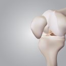 센텀튼튼정형외과의원 이미지