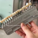 세정치과의원 | 천안치과 직산 치아미백✨ 시림 없는 미백 시술 후기/ 과정 주의사항