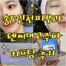 송도 인천피부과 텐써마 고주파리프팅 직접 받은 솔직후기 (비교사진)