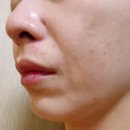 홀리언니 | 내돈내산 피캄 홀리바질 버블 딥 마스크 후기3 (2주)