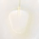 예항맥외과 | 치핵4기 치질수술 후기 2일차~5일차