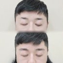 울산눈썹문신 받고 아침이 정말 편해졌어요 (에스이엠뷰티 후기)
