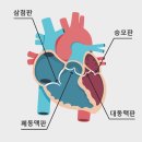 심장 판막 질환[valvular heart disease] 이미지