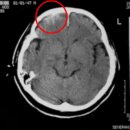 박용신경외과 이미지