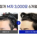 포뮬라의원 이미지