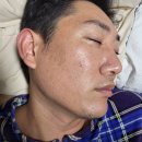 킴스비뇨기과의원 | 오산 동탄 점 잘빼는 병원 피부과 점빼기 점제거 쥐젖제거 사마귀제거 솔직후기 삼성킴스비뇨기과피부과
