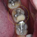 다대2동-2 이미지