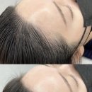 이미지헤어라인 이미지
