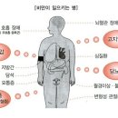 헬스중독 이미지