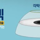 다담치과의원 | 나 라식하고 왔다