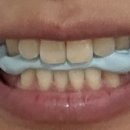 센텀고운선형한의원 이미지