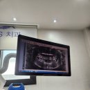 세브란스안경 이미지